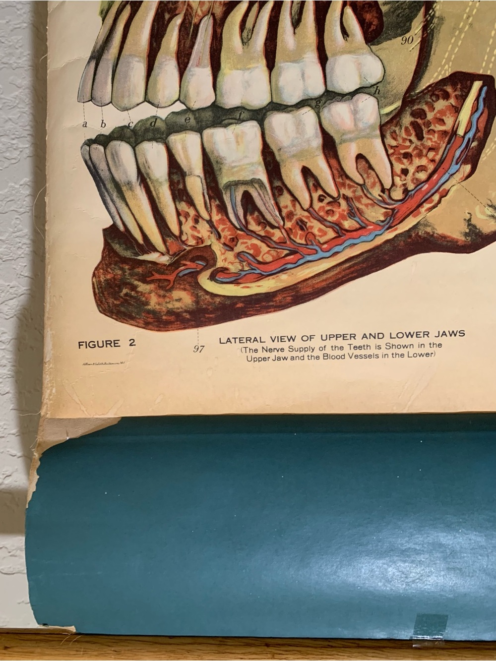 Antique American Frohse Anatomical Chart Head and Neck Signed Max Brotel 1919 - Picture 9 of 16
